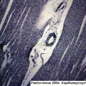 Микроскоп Optika B-192PLi 40x-1600x Bino Infinity