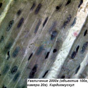 Микроскоп Optika B-192PLi 40x-1600x Bino Infinity