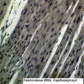 Микроскоп Optika B-193 40x-1600x Trino